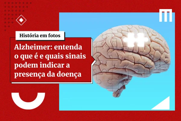 Estudo encontra variante genética que pode triplicar risco de Alzheimer