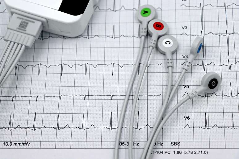 Estresse pode causar arritmia cardíaca? Entenda quadro que levou Janones à UTI