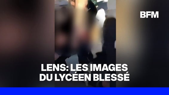 IMAGES SENSIBLES - Un lycéen de 15 ans a eu la main "arrachée" à Lens, l'IGPN saisie