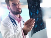 Estudo encontra variante genética que pode triplicar risco de Alzheimer