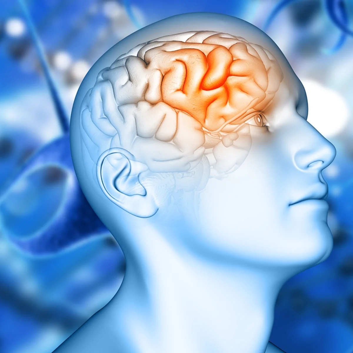 Estudo encontra variante genética que pode triplicar risco de Alzheimer