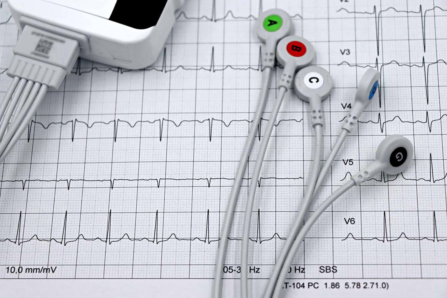 Exame cardiológico