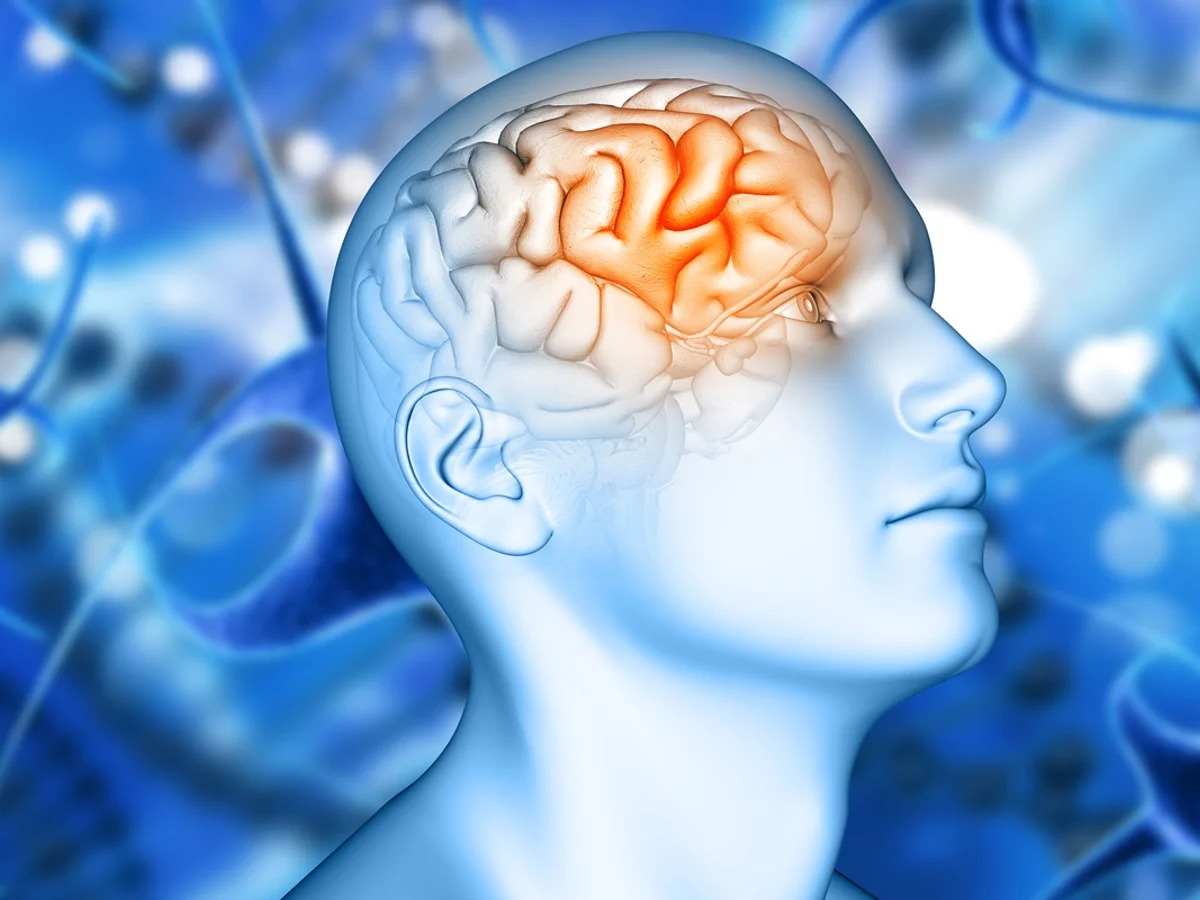 Estudo encontra variante genética que pode triplicar risco de Alzheimer